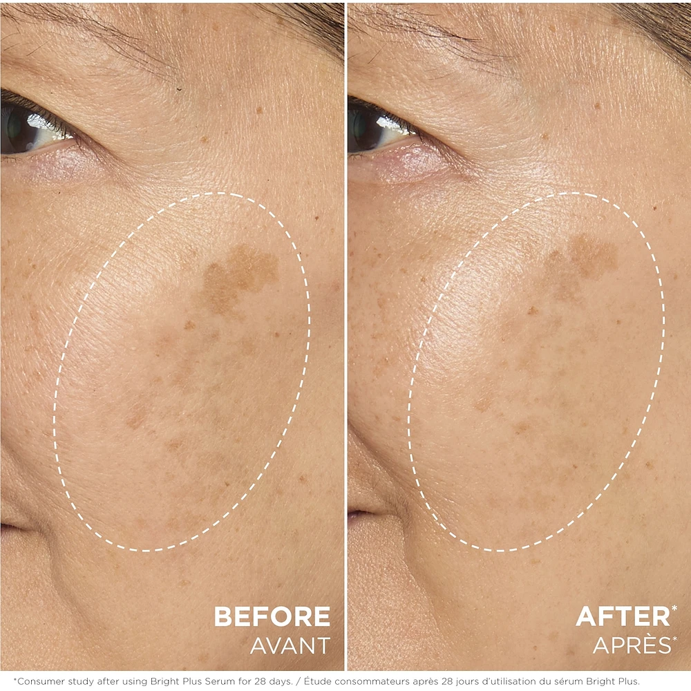 Bright Plus [Advanced] Serum