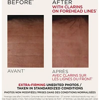 Extra-Firming Day - Dry Skin Refill