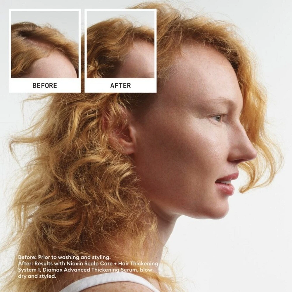 Nioxin Scalp + Hair Thickening System 1 - for Natural Hair with Light Thinning - Includes Shampoo 150ml, Conditioner 150ml and Scalp Treatment 50ml