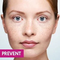 Clera Cold Sore Treatment