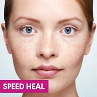 Clera Cold Sore Treatment