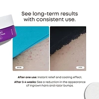 Radiant Reset Exfoliating Toner Pads for Dark Spots and Ingrown Hairs