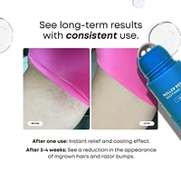 Roller Rescue Soothing Serum for Ingrown Hairs & Bumps