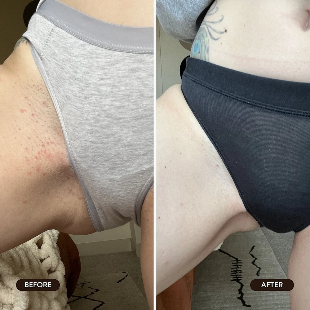 Watermelon Sugar Ingrown Hair Scrub