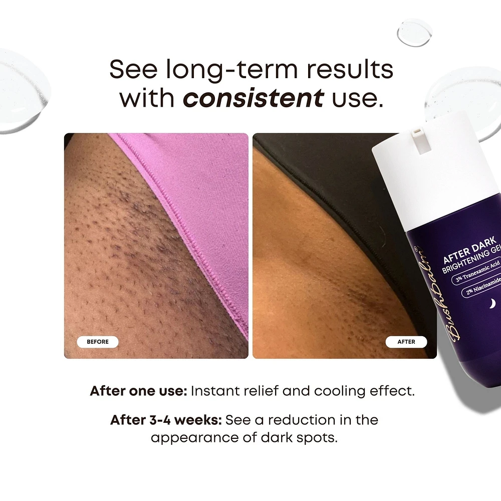 After Dark Brightening Gel for Dark Spots