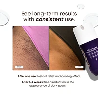 After Dark Brightening Gel for Dark Spots