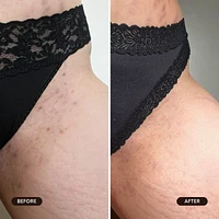 Watermelon Sugar Ingrown Hair Oil