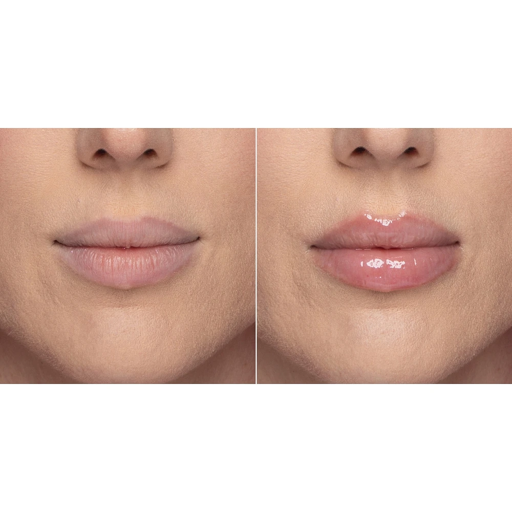 Lip Injection Extreme Plumper