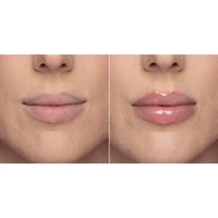 Lip Injection Extreme Plumper