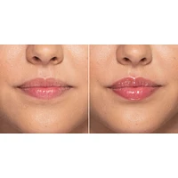 Lip Injection Extreme Plumper