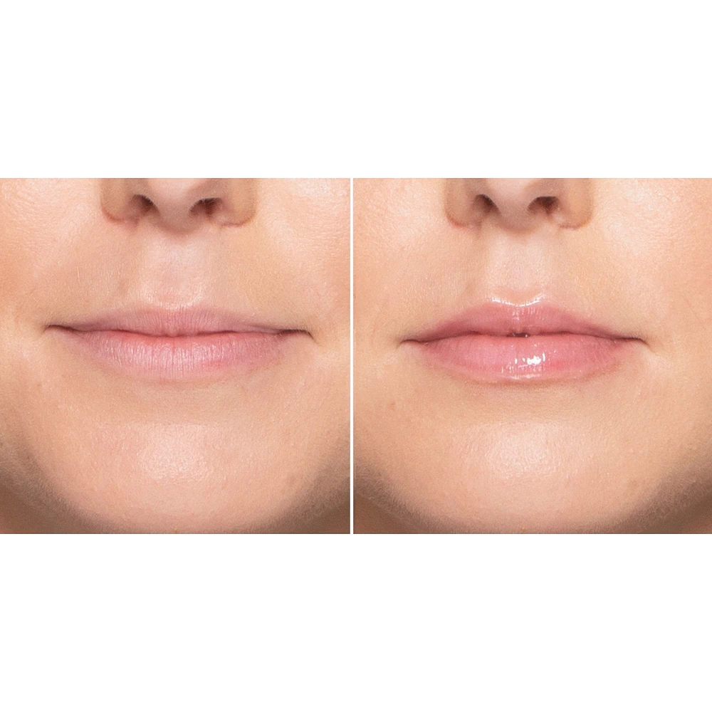 Lip Injection Extreme Plumper