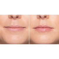Lip Injection Extreme Plumper