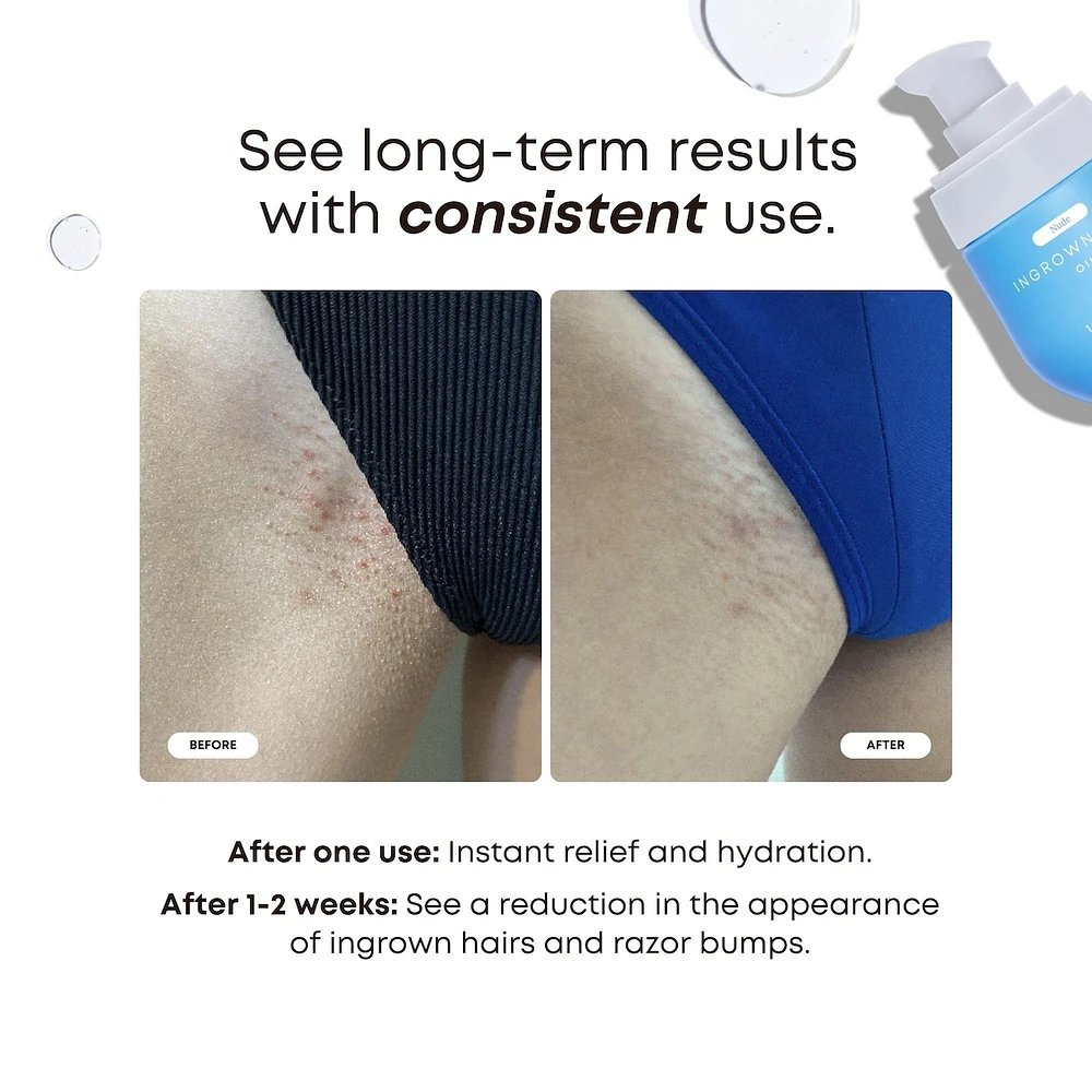 Nude Ingrown Hair Oil
