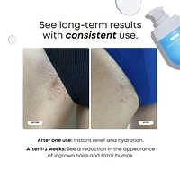 Nude Ingrown Hair Oil