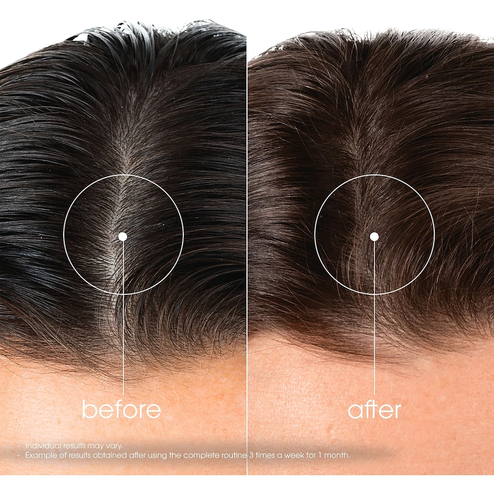 Shampoo with Quinine & ORGANIC Edelweiss - Strengthening for thinning hair