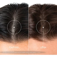 Shampoo with Quinine & ORGANIC Edelweiss - Strengthening for thinning hair
