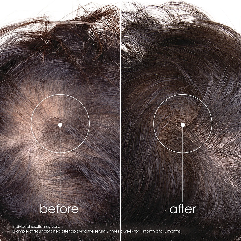 Strengthening Serum with Quinine and ORGANIC Edelweiss - Strengthening for thinning hair