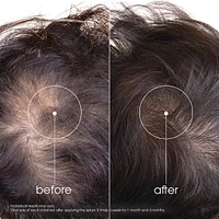 Strengthening Serum with Quinine and ORGANIC Edelweiss - Strengthening for thinning hair