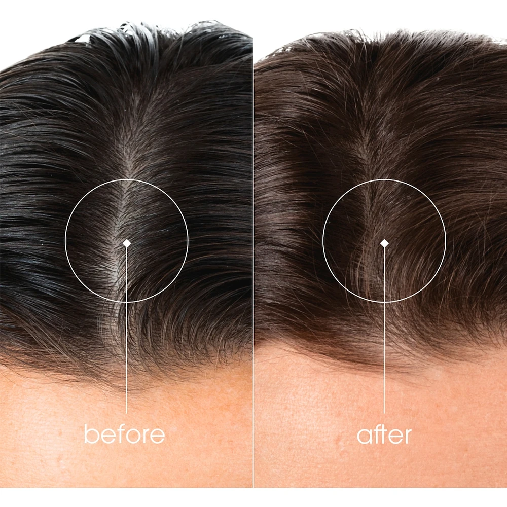 KeratinCaps - Strength & vitality for hair & nails - with organic Quinine
