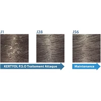 Kertyol PSO shampoo