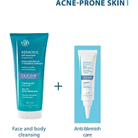 Keracnyl cleansing gel NEW
