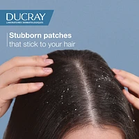Kelual Squanorm Normalizing shampoo - Oily loose dandruff