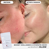 GLOW Skincare Gummies for Hydration, Collagen Boosting