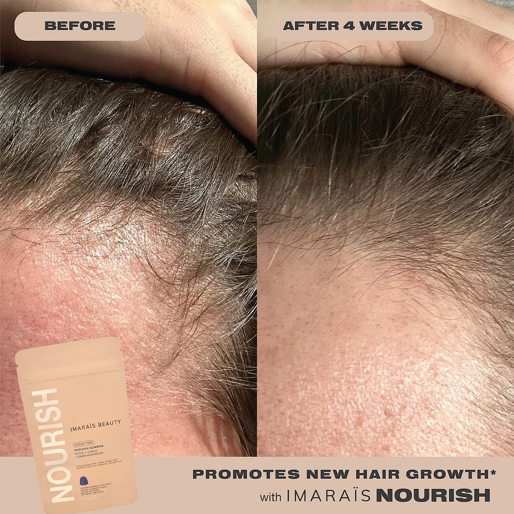 NOURISH Haircare Gummies for Hair Growth, Anti-Shedding