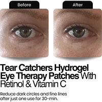 Tear Catchers Hydrogel Wrinkle & Stress-Relief Forehead & Eye Therapy Kit with Retinol & Vitamin C (x2 sets)
