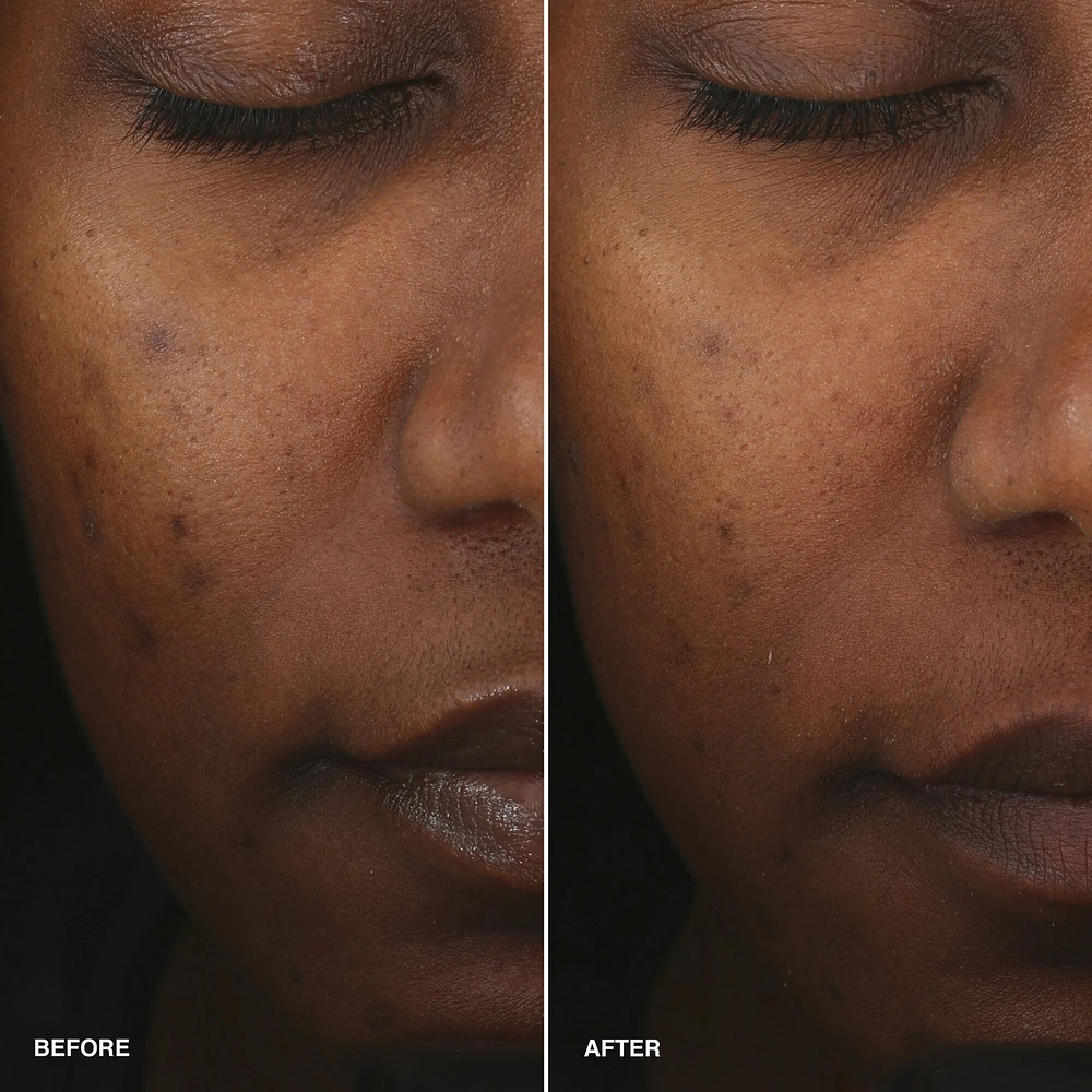 Vitamin Enriched Smoothing Serum