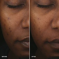 Vitamin Enriched Smoothing Serum