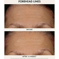 Plantscription™ Multi-Powered Youth Serum