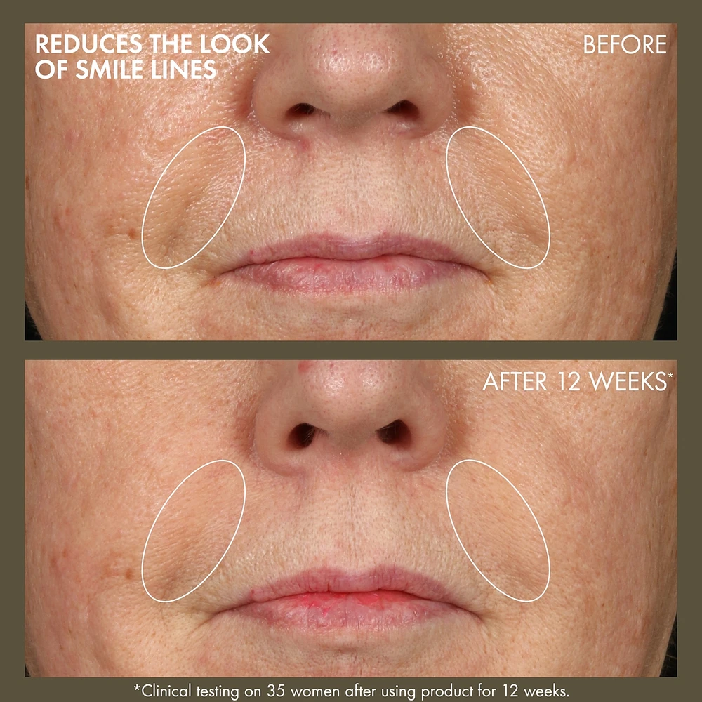 Plantscription™ Active Wrinkle Correction Serum with Retinoid