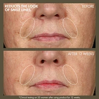 Plantscription™ Active Wrinkle Correction Serum with Retinoid