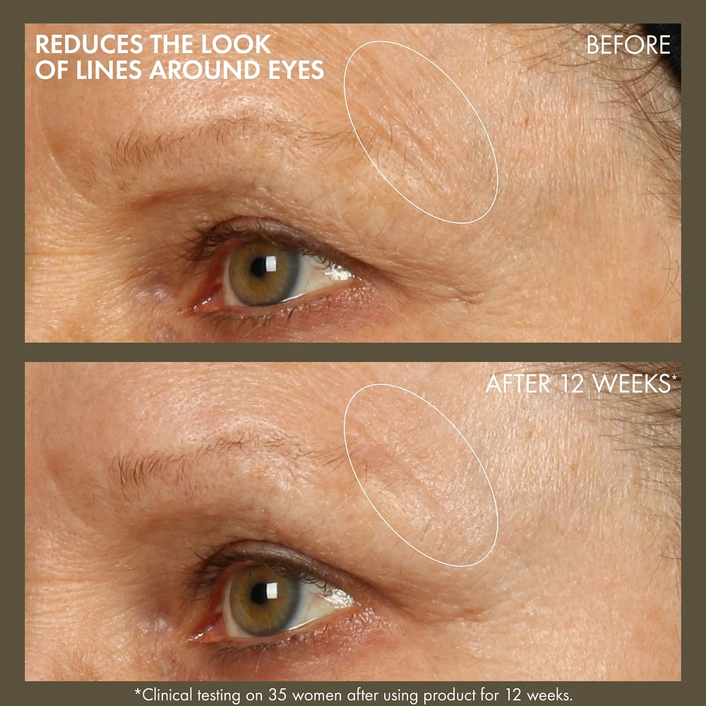 Plantscription™ Active Wrinkle Correction Serum with Retinoid