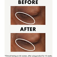 Ginzing™ Vitamin C Eye Cream To Brighten And Depuff