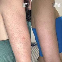 RE-START Resurfacing Body Serum