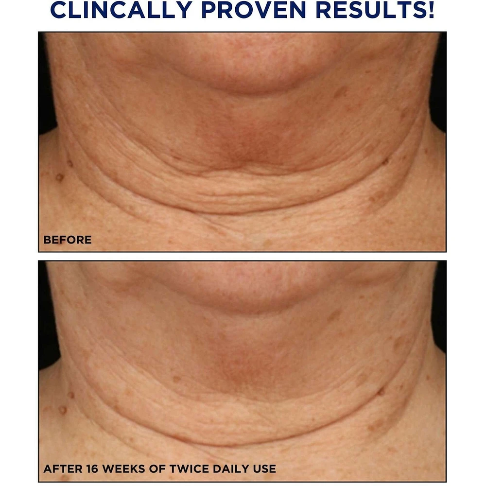 Triple Firming Neck Cream