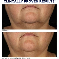 Tri-Therapy Lifting Serum