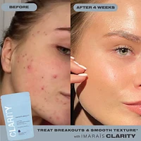 CLARITY Anti-Blemish Gummies for Clear Complexion