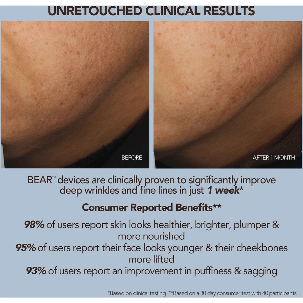 BEAR 2 Lavender Advanced Microcurrent Facial Toning Device