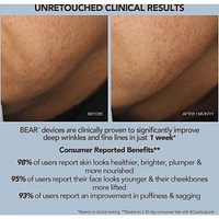 BEAR 2 Lavender Advanced Microcurrent Facial Toning Device