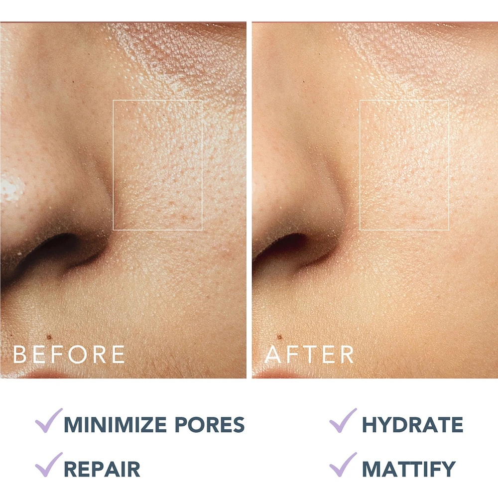KIWI™ Oil Control Mattifying Moisturizer
