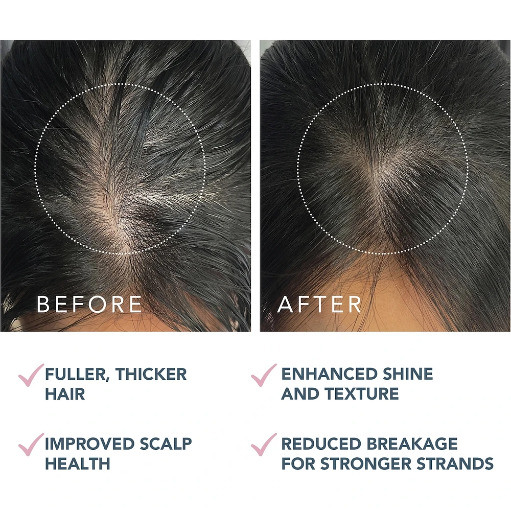 LUNA™ Dual-Peptide Scalp Serum
