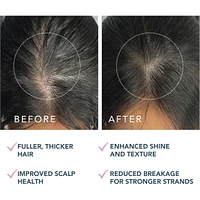 LUNA™ Dual-Peptide Scalp Serum
