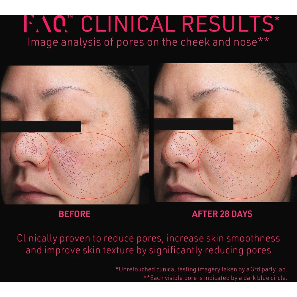 FAQ™ 102 Professional Radiofrequency
