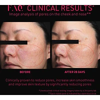 FAQ™ 102 Professional Radiofrequency