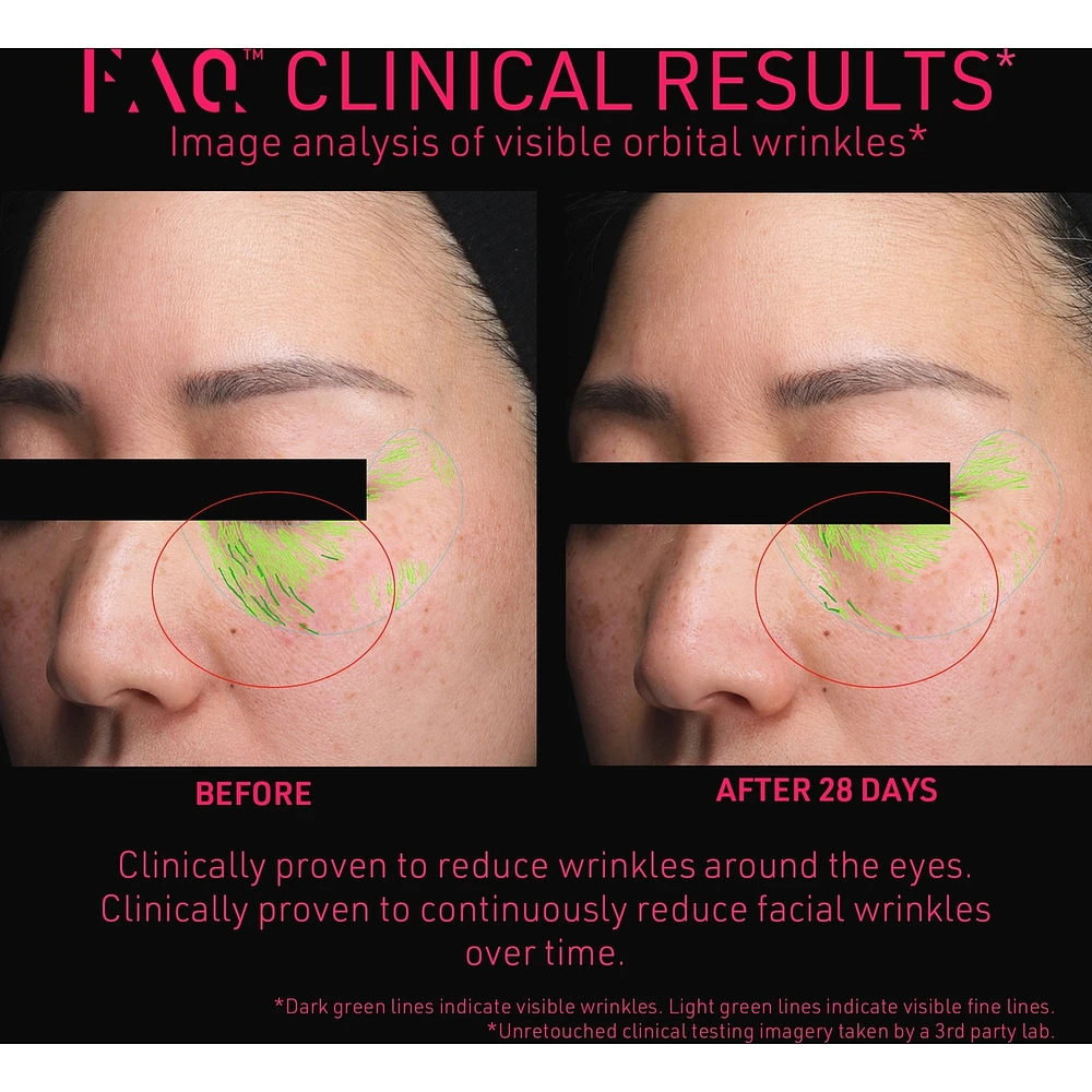 FAQ™ 102 Professional Radiofrequency