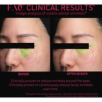 FAQ™ 102 Professional Radiofrequency
