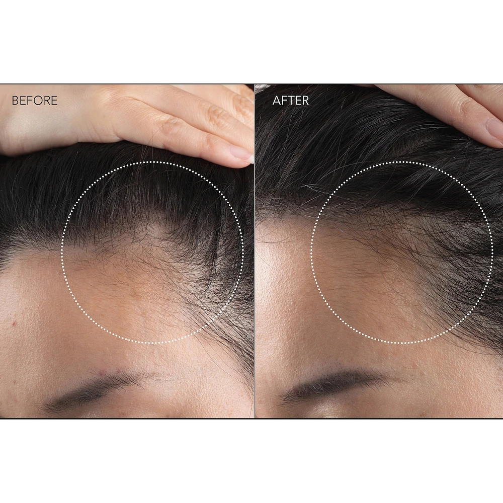 FAQ™ 301 LED Hair Strengthening Scalp Massager